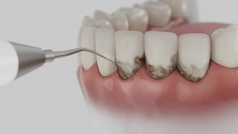 Reliable Teeth Cleaning And Checkup contractor in Bath County County, VA by Dentist Open Now